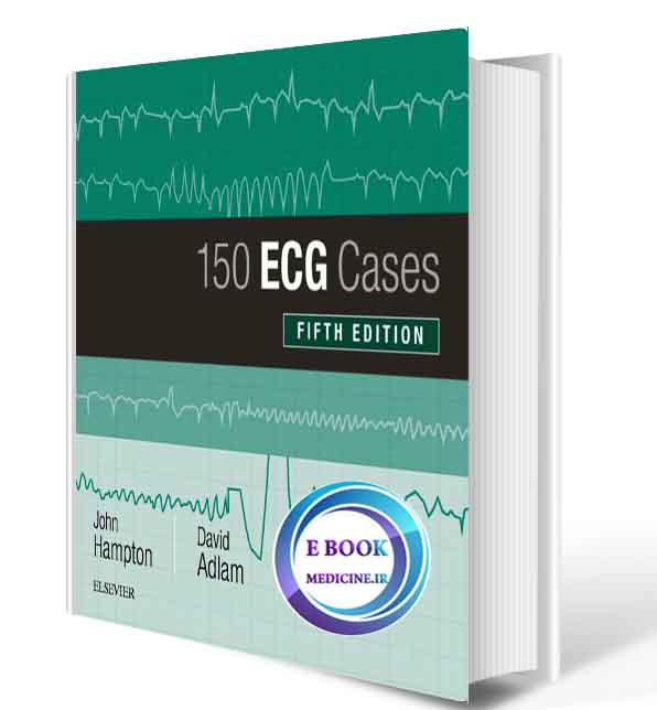 دانلود کتاب 150 ECG Cases2019(ORIGINAL PDF)